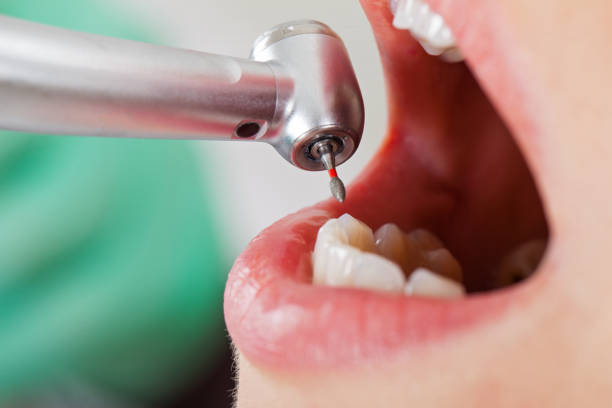 Best Emergency Dental Surgery in Garberville, CA